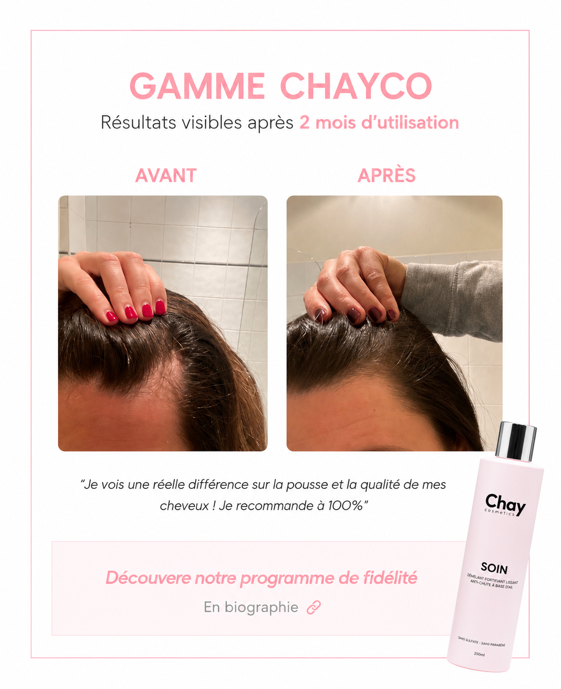 Témoignage Chay fourni par la marque : photos avant et après