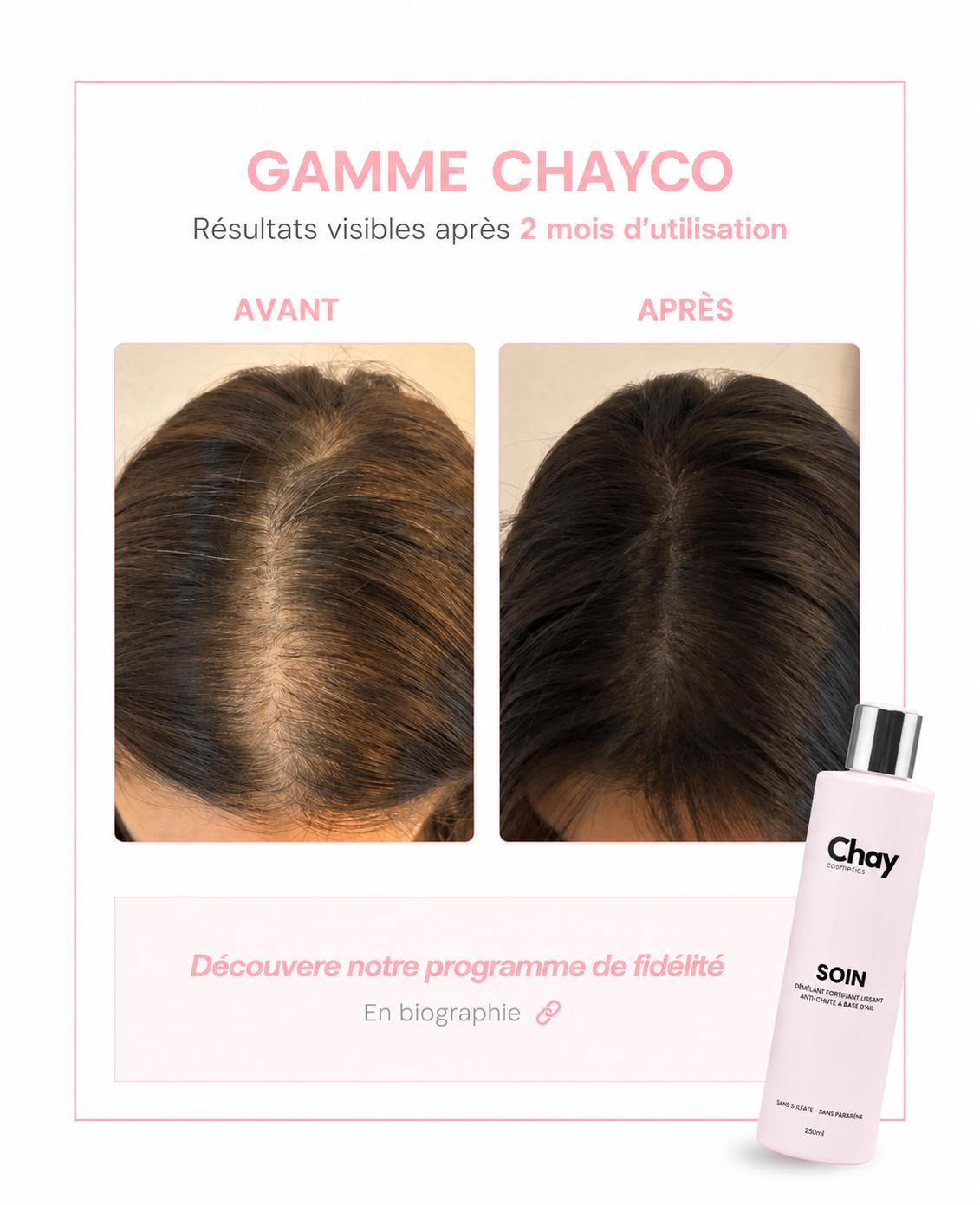 Deuxième témoignage Chay fourni par la marque